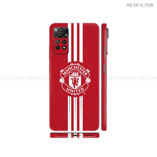 Dán Skin Xiaomi Redmi Note 11 Series Hình CLB Bóng Đá | D_TT06
