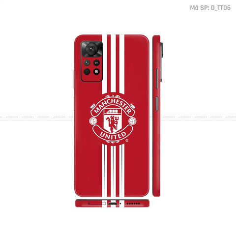 Dán Skin Xiaomi Redmi Note 11 Series Hình CLB Bóng Đá | D_TT06