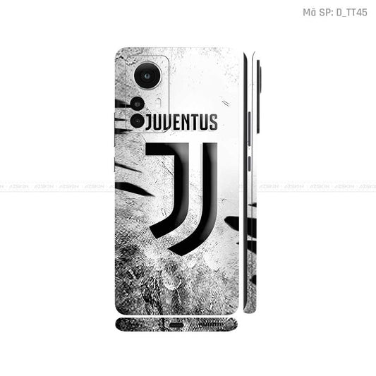 Dán Skin Xiaomi 12 Series Hình CLB Bóng Đá | D_TT45