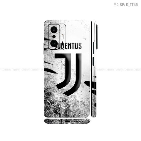 Dán Skin Xiaomi 11 Series Hình CLB Bóng Đá | D_TT45