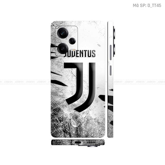 Dán Skin Xiaomi Redmi Note 12 Series Hình CLB Bóng Đá | D_TT45