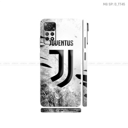Dán Skin Xiaomi Redmi Note 11 Series Hình CLB Bóng Đá | D_TT45